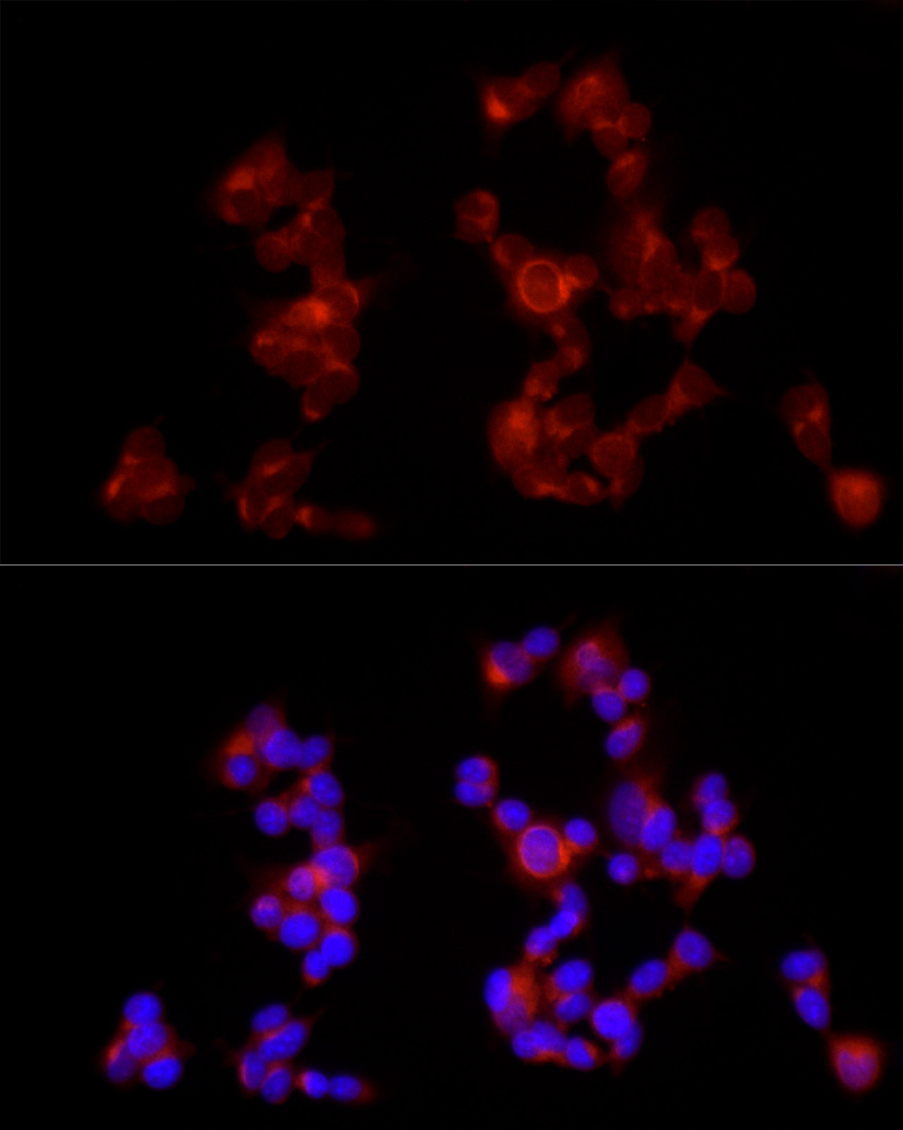 GABBR1 Rabbit Polyclonal Antibody - Image 2