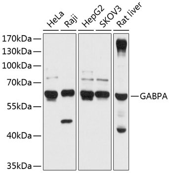 GABPA Rabbit Polyclonal Antibody