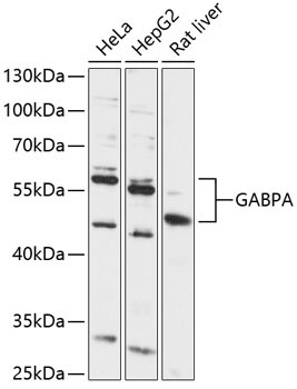 GABPA Rabbit Polyclonal Antibody
