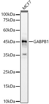 GABPB1 Rabbit Polyclonal Antibody