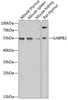 GABPB2 Rabbit Polyclonal Antibody