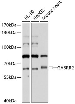 GABRR2 Rabbit Polyclonal Antibody