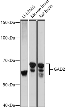 GAD65/GAD2 Rabbit Polyclonal Antibody