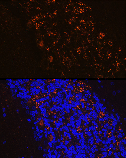 GAD65/GAD2 Rabbit Polyclonal Antibody - Image 2