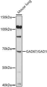 GAD67/GAD1 Rabbit Polyclonal Antibody