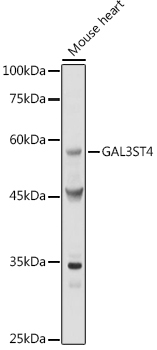GAL3ST4 Rabbit Polyclonal Antibody - Image 2