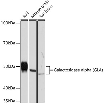 Galactosidase alpha (GLA) Rabbit Monoclonal Antibody