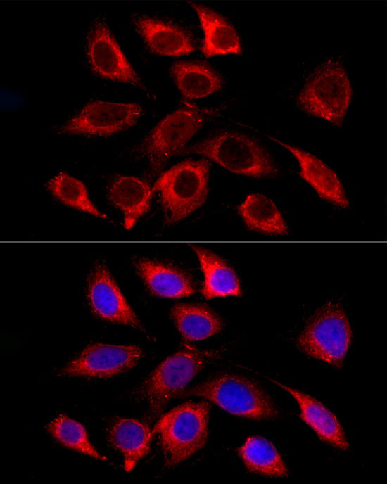 GALC Rabbit Monoclonal Antibody