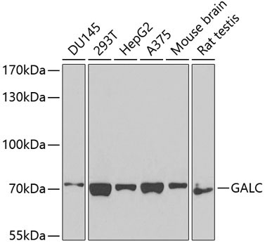 GALC Rabbit Polyclonal Antibody