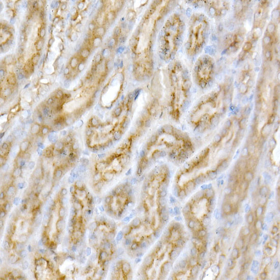 GALC Rabbit Polyclonal Antibody - Image 2