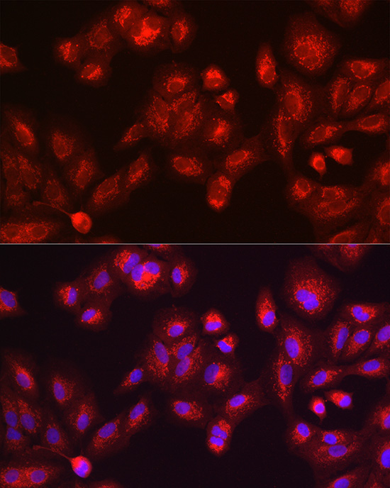 GALC Rabbit Polyclonal Antibody - Image 3