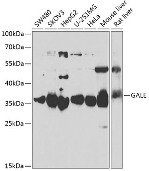 GALE Rabbit Polyclonal Antibody