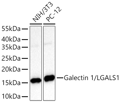 Galectin 1/LGALS1 Rabbit Monoclonal Antibody