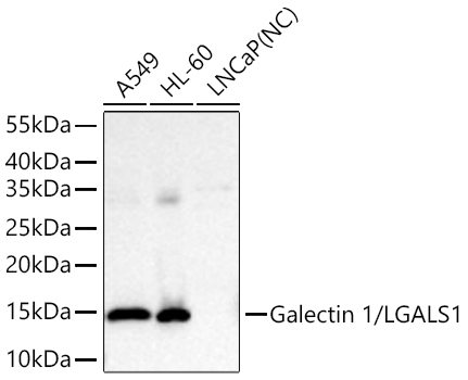 Galectin 1/LGALS1 Rabbit Monoclonal Antibody - Image 2