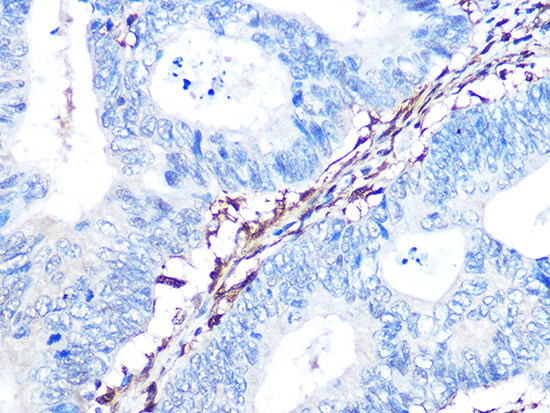 Galectin 1/LGALS1 Rabbit Monoclonal Antibody - Image 3