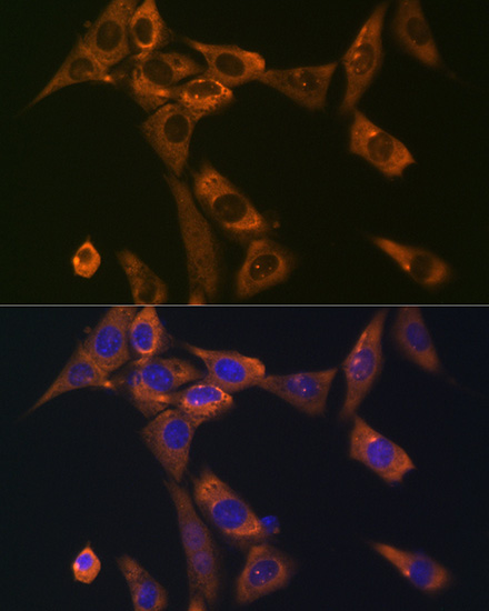 Galectin 1/LGALS1 Rabbit Monoclonal Antibody - Image 4