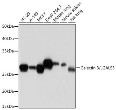 Galectin 3/LGALS3 Rabbit Monoclonal Antibody