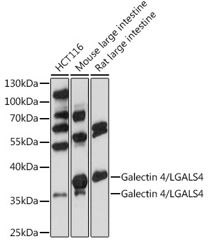 Galectin 4/LGALS4 Rabbit Polyclonal Antibody