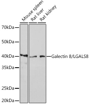 Galectin 8/LGALS8 Rabbit Monoclonal Antibody