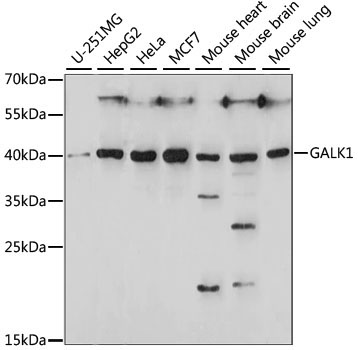 GALK1 Rabbit Polyclonal Antibody