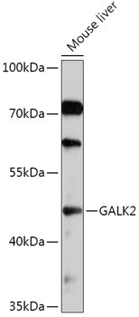 GALK2 Rabbit Polyclonal Antibody