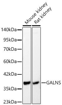 GALNS Rabbit Polyclonal Antibody