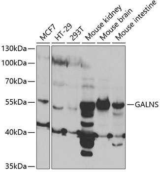 GALNS Rabbit Polyclonal Antibody