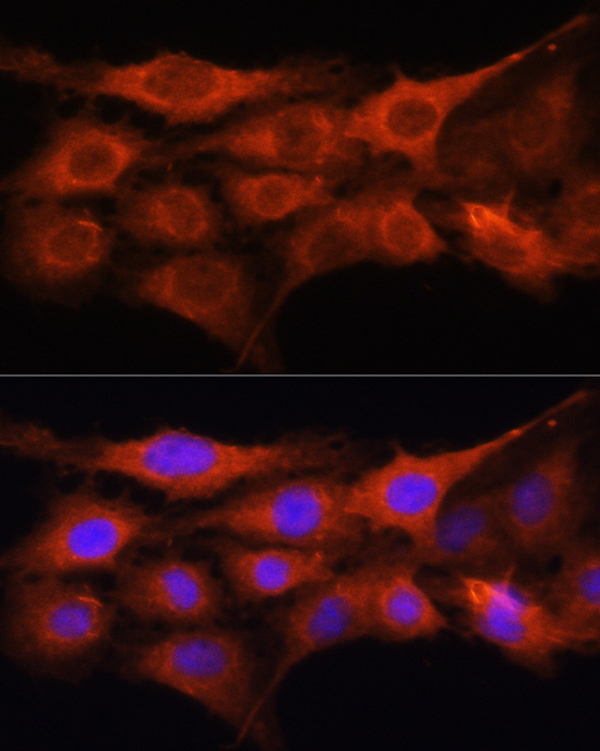 GALNS Rabbit Polyclonal Antibody - Image 2