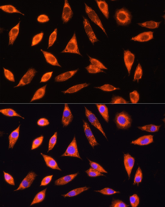 GALNS Rabbit Polyclonal Antibody - Image 3