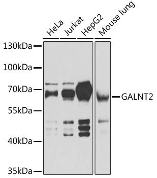 GALNT2 Rabbit Polyclonal Antibody