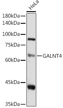 GALNT4 Rabbit Polyclonal Antibody