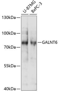 GALNT6 Rabbit Polyclonal Antibody