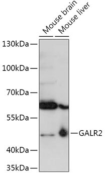 GALR2 Rabbit Polyclonal Antibody
