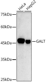 GALT Rabbit Monoclonal Antibody