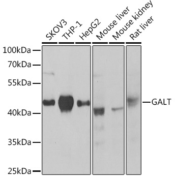 GALT Rabbit Polyclonal Antibody
