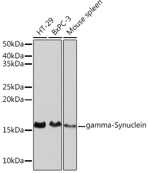 gamma-Synuclein Rabbit Monoclonal Antibody