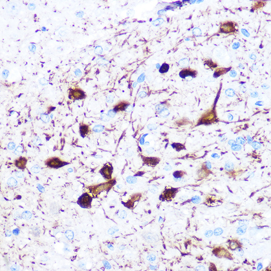 gamma-Synuclein Rabbit Monoclonal Antibody - Image 2