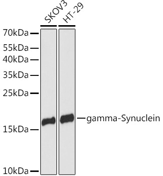 gamma-Synuclein Rabbit Polyclonal Antibody