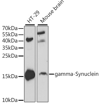 gamma-Synuclein Rabbit Polyclonal Antibody