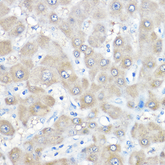 GAMT Rabbit Polyclonal Antibody - Image 2