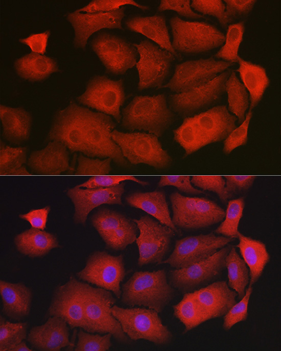 GAMT Rabbit Polyclonal Antibody - Image 3