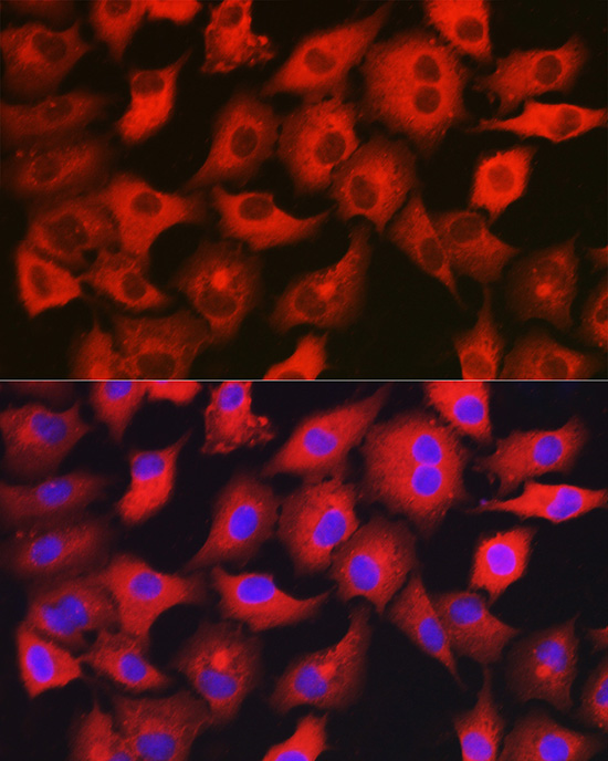 GAMT Rabbit Polyclonal Antibody - Image 4