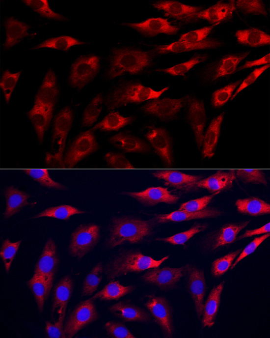 GAMT Rabbit Polyclonal Antibody - Image 5