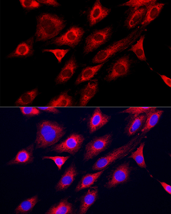 GAMT Rabbit Polyclonal Antibody