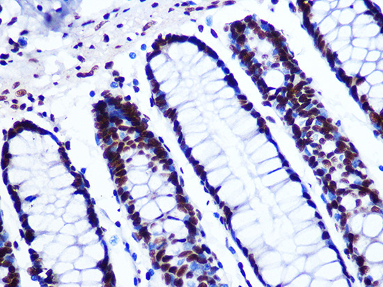 GTPBP4 Rabbit Monoclonal Antibody - Image 2