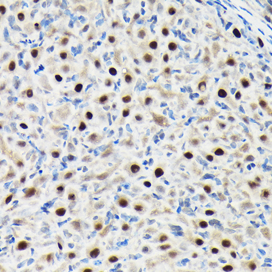 GTPBP4 Rabbit Polyclonal Antibody - Image 2