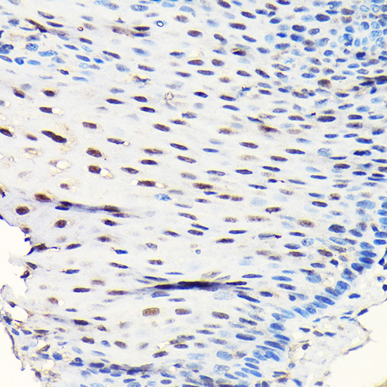 GTPBP4 Rabbit Polyclonal Antibody - Image 3