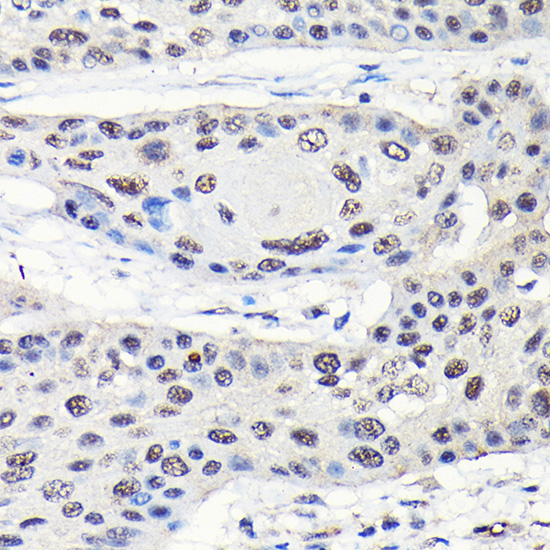 GTPBP4 Rabbit Polyclonal Antibody - Image 4