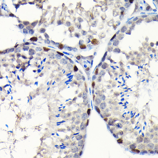 GTPBP4 Rabbit Polyclonal Antibody - Image 5