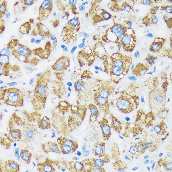 GTPBP8 Rabbit Polyclonal Antibody - Image 2